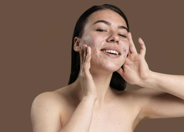 Ácido azelaico: para que serve na acne e nas manchas